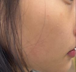 -长沙雅美医疗美容医院