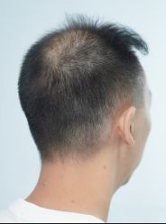 -唐风采假发补发定制