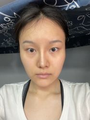 -成都西区医院整形美容