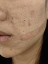 -深圳米兰柏羽医疗美容医院