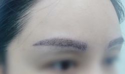 -八大处整形