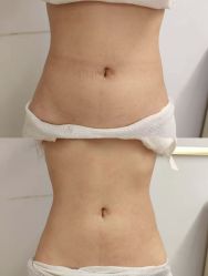 -Lily纤美·科技减脂中心