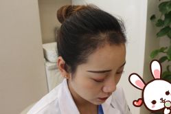 点击看大图 -大麦微针植发丨全国连锁