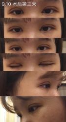 -成都西区医院整形美容