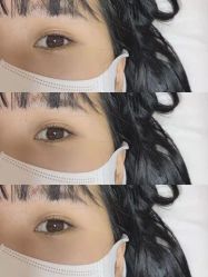 点击看大图 -U-Nail