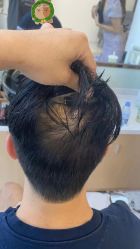 -发饰美男士增发补发假发定制店