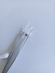 -美丽人生祛斑扁平疣汗管瘤中心
