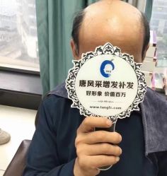 -唐风采假发补发定制