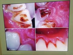 -深圳富茂格伦菲尔口腔门诊部(龙华清湖总院)