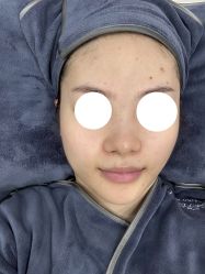 体验前-深圳医恒美医疗美容