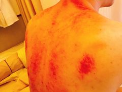 -蓉城阳光推拿馆(新华公园店)