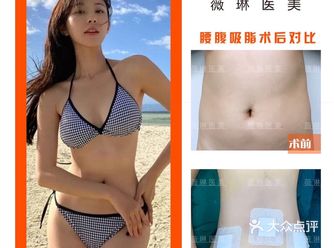 吸脂手术后哪些现象属于正常反应呢？