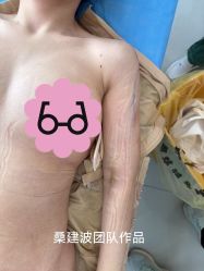 -杭州米兰柏羽医疗美容医院