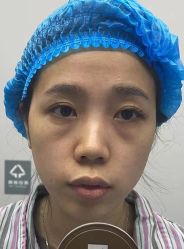 -天津健丽·去眼袋医疗美容机构