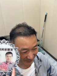 -唐风采假发补发定制