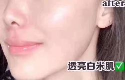 -正璞医疗美容·皮肤修复·微整注射