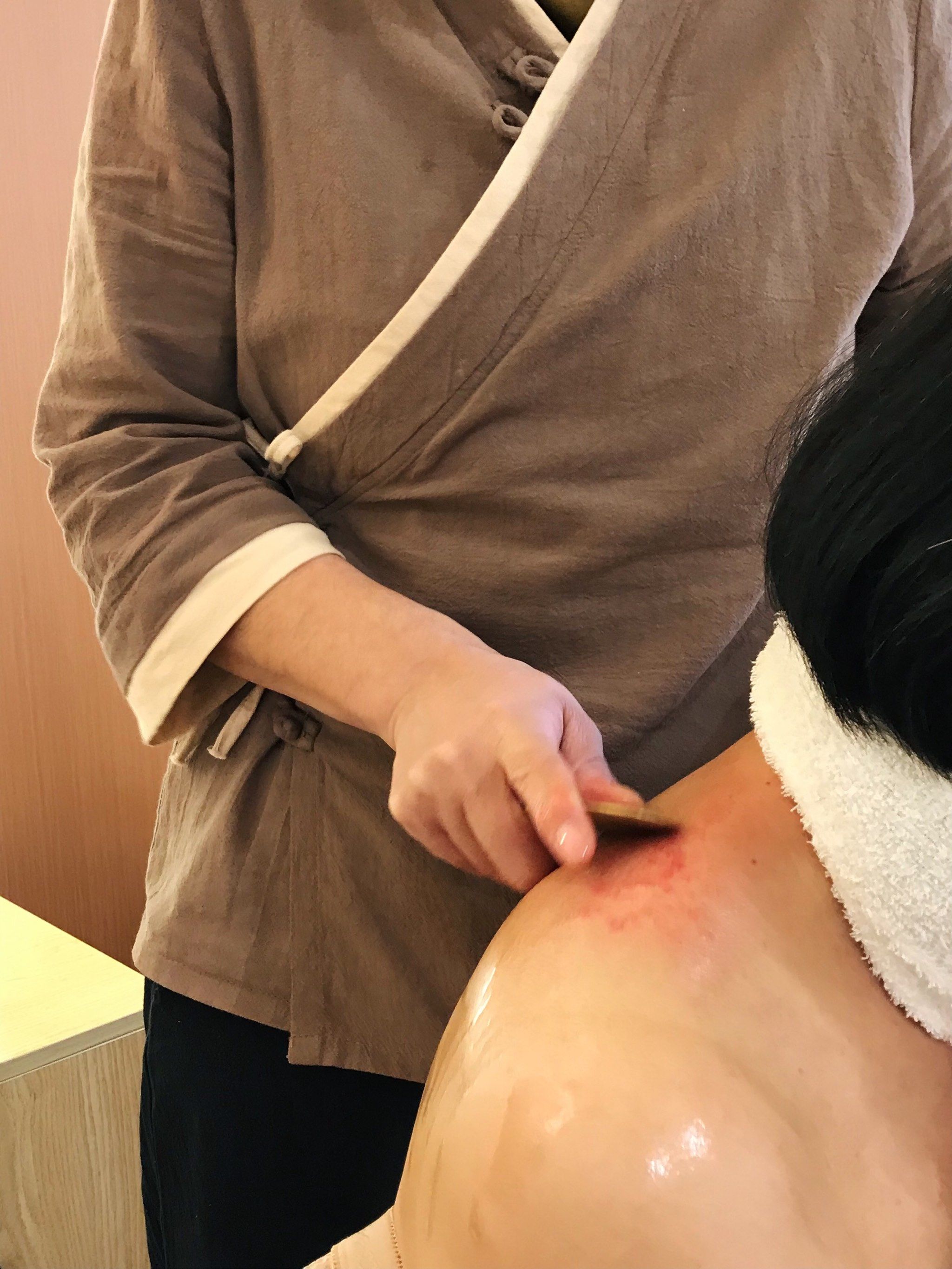 真神奇刮痧一点都不疼