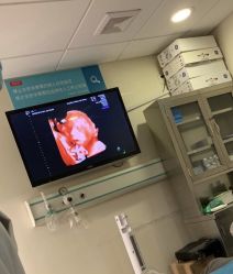 -杭州贝瑞斯美华妇儿医院·早孕·产检·儿科