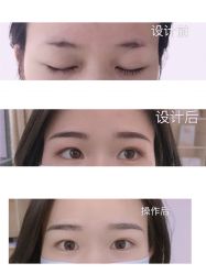-久匠半永久纹眉