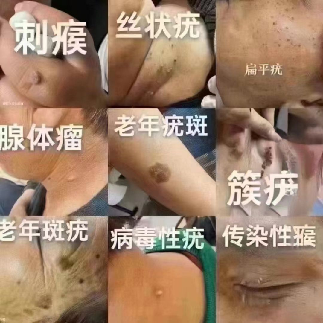 【皮肤知识科普