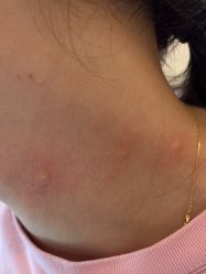 -清疣美疣·痣·斑净肤中心