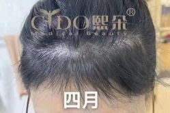 -熙朵美学植发连锁