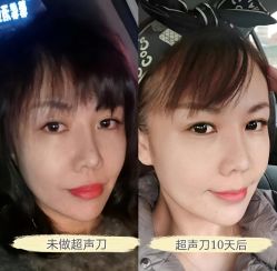 -上海伊莱美医疗美容医院