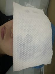 -长沙雅美医疗美容医院