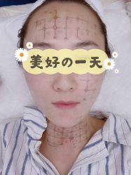 -北京楚诺医疗美容