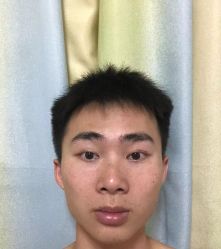 -天津健丽·去眼袋医疗美容机构