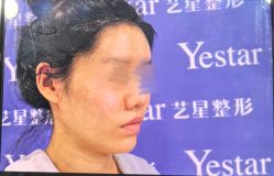 -Yestar宁波艺星整形医院