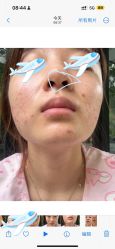 -杭州美莱医疗美容医院