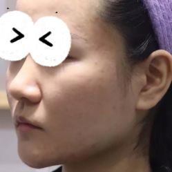 体验前-和颜一美轻医美连锁