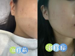 -Yestar 嘉兴艺星医疗美容医院