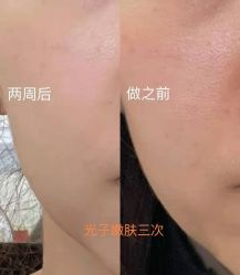 -上海漾颜医疗美容