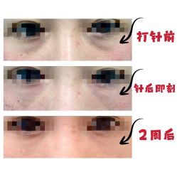 -八大处整形