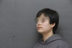 体验后-圣嘉新医疗美容医院