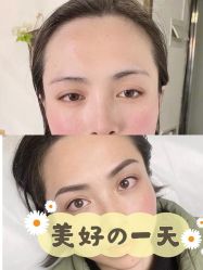 点击看大图 -Doris多里斯半永久纹眉·SMP纹发·发际线
