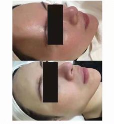 -美肤盾祛痘·问题肌头疗管理中心