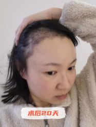 -雍禾植发全国连锁