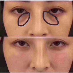 -兰派国际美容养生SPA