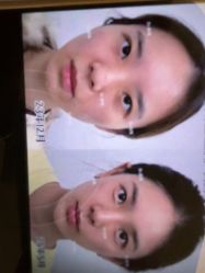 -Yestar杭州艺星医疗美容医院