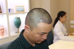 -大麦微针植发丨全国连锁