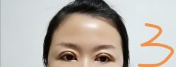 点击看大图 -八大处整形