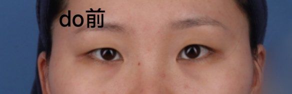 -广州美莱医疗美容医院