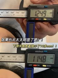 -颜和骨正·明哲式骨相美学整骨