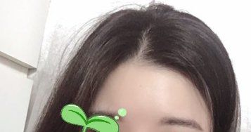 -大麦微针植发丨全国连锁