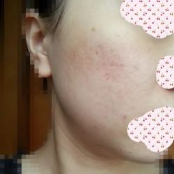 -SKINIST丽铂医疗美容