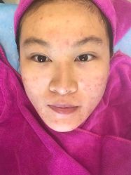 -北京米扬丽格医疗美容·联合丽格鼻整形中心