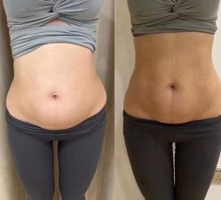 -卡莫瑜伽·普拉提